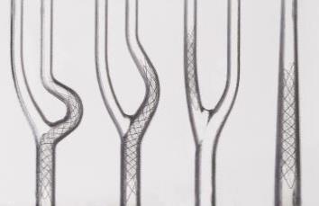 the new stent performance In-vessel flexibility Double