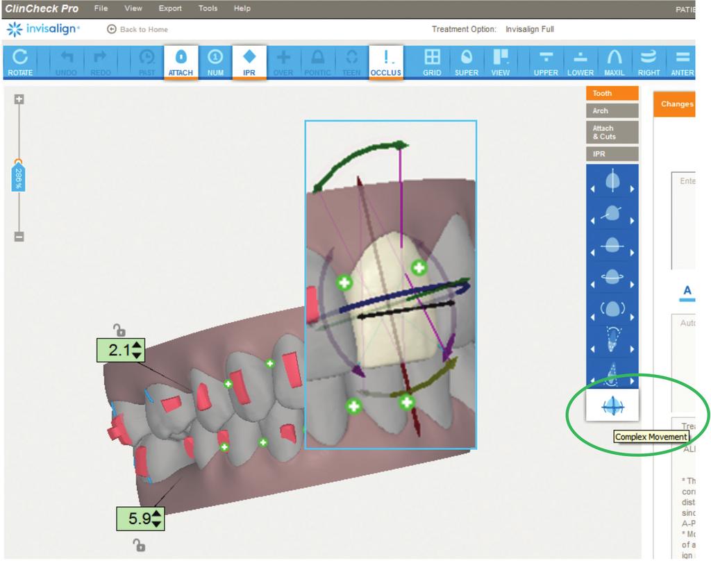 click, and moved using any of the selected tooth widgets. Complex Movement 3D Control.