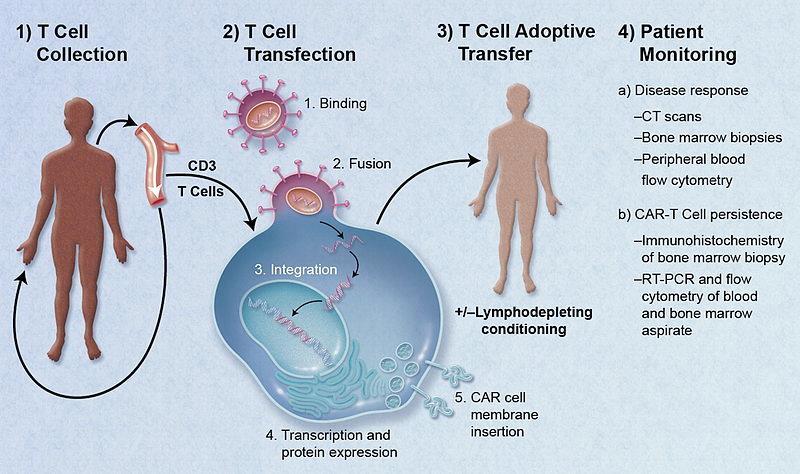 CAR T Cells Chimeric antigen receptor T cells engineered T cells bind to a specific antigen e.g. CD20 in CLL.