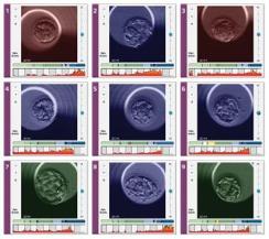 Assessment of embryo quality Invasive embryo selection PGD (polar bodies, blastomeres, trophectoderm)