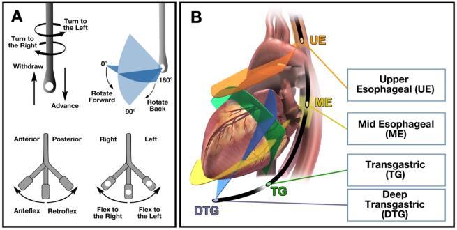 Four Levels of Imaging for the Tricuspid Valve: 1.