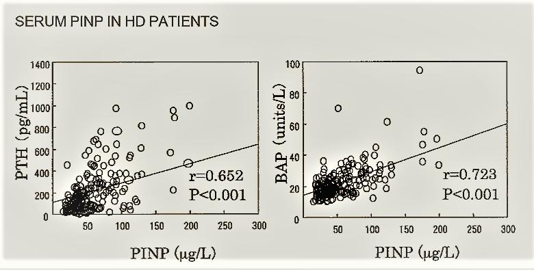 Correlations between serum P1NP values and values of other biochemical markers of bone metabolism in 195 male HD patients.
