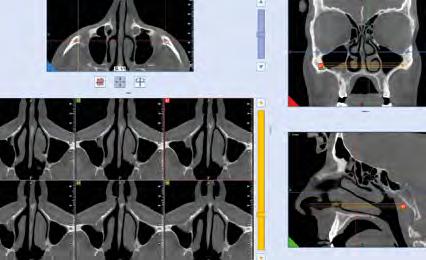 28 29 NNT. INTEGRATED SOFTWARE PLATFORM. The ultimate platform to acquire, process and share 2D/3D diagnostic images.
