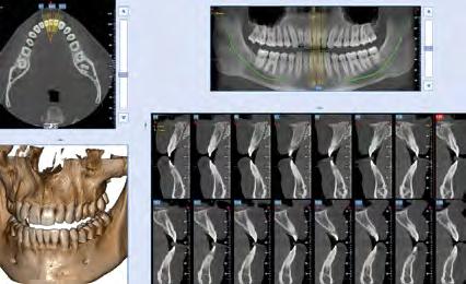 maxillary and mandibular bones and teeth.