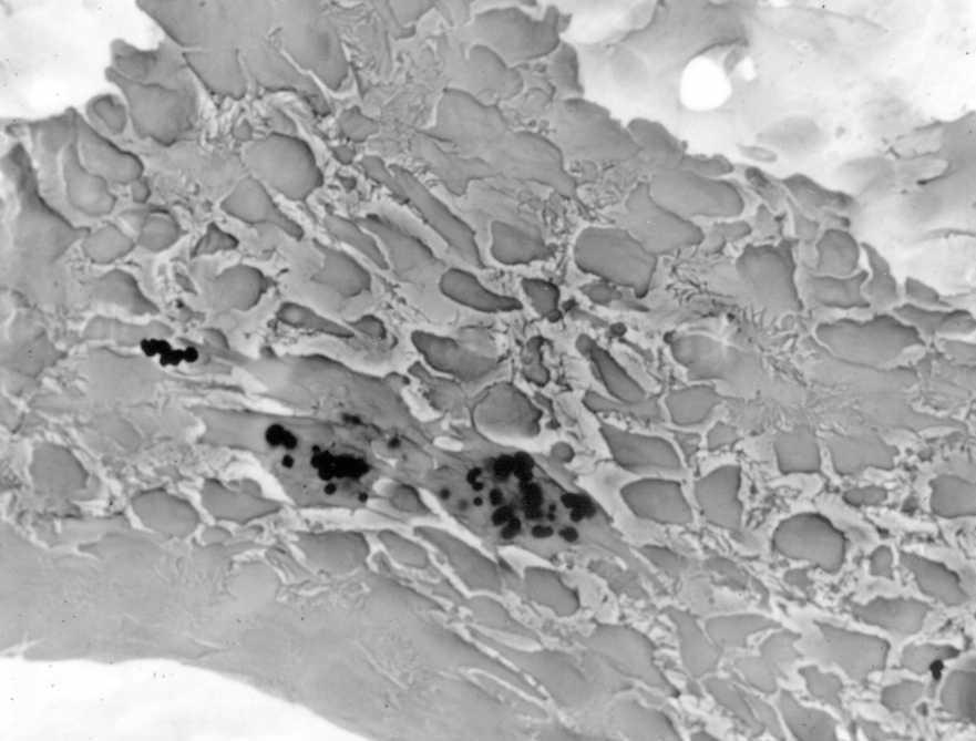 Alveolar Macrophage Migration to Iron Particle
