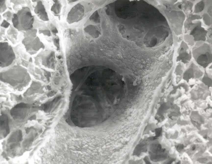 Alveolar Macrophage Clearance of