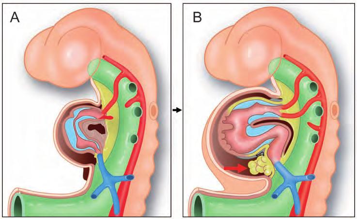 Chapter 1 Figure 1. Early cardiac development. Panel A: The primary heart tube with an inlet portion, blue vessel and an outlet portion, red vessel. The yellow area demarcates the second heart field.