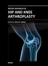 Recent Advances in Hip and Knee Arthroplasty Edited by Dr.