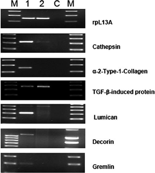 INTERNATIONAL JOURNAL OF ONCOLOGY 38: 1645-1652, 2011 1649 MET-tyrosine kinase (MET), β-2-adrenergic receptor (β-2ar), stromal cell derived factor receptor 1 (CXCR4), ATP5G3, 5-tubulin,