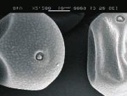 Ethirajan, A. S. (1953). Pollen grains in Saccharum and certain allied genera. Curr. Sci., 22:385-386. [6]. Rowly, J. (1960). Exine structure of cereal and wild type grass pollen. Grana Palynol.