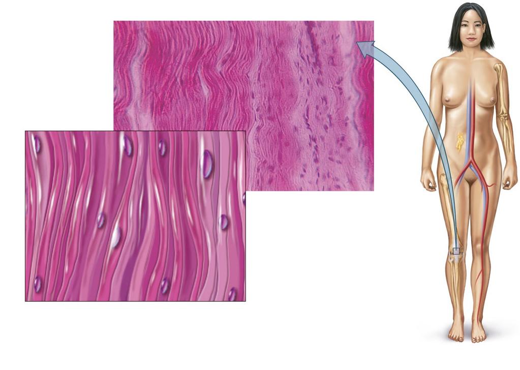 Dense connective tissue Dense connective tissue Found in tendons and