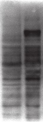 The p-tyr patterns of their lysates were analysed by immunoblotting with an anti-p-tyr antibody.