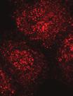 (d) HeLa cells secrete procollagen-iv (PC-IV) in a synchronisable fashion.