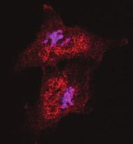 2 mg ml -1 FITC-labelled dextran (marker), as Sar1-GTP microinjection blocks ER-to-Golgi transport. The cells were then shifted to 32 C for 3 min and double-stained for GM13 (blue) and p-sfks (red).