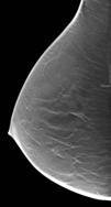 contrast with contrast Digital breast tomosynthesis is technically