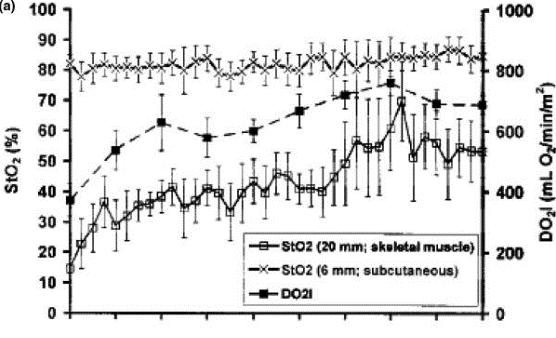 NIRS StO 2 (at 20 mm, skeletal muscle) is an index of profusion that