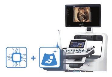 Our new A35 system establishes new benchmarks in operational convenience with features such as EZ Exam and ElastoScan.
