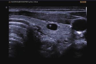 Abnormal hand with FRV Fetal ear with FRV DMR+ HD Volume Imaging A new engine that integrates Samsung software and enhances image quality,