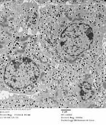 () Representative thin section electron micrographs of isolated and / islets. Scale bar, µm.
