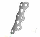 The Orthopedic Implant Market Implants (hip, knee, shoulder, ankle, fingers, trauma) Huge market with some global players Potential (US) - Orthopedic Equipment 12,5 billion $ Trauma/Fixation 1,6
