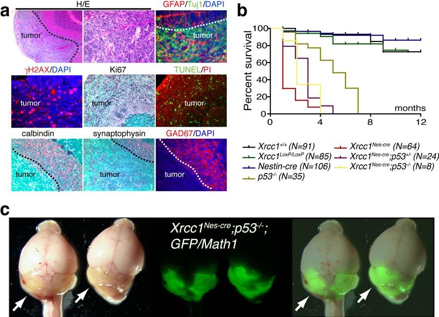 Lee et al, Genesis of cerebellar interneurons SUPPLEMENTARY DATA 13 Supplementary Figure 12. Xrcc1 Nes-cre ;p53 -/- mice develop medulloblastoma.