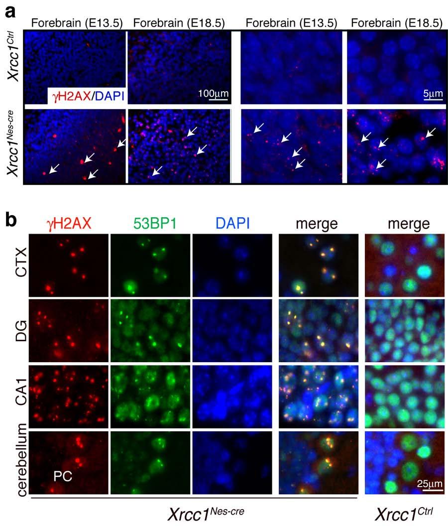 Lee et al, Genesis of cerebellar interneurons SUPPLEMENTARY DATA 4 Supplementary Figure 3. DNA damage is present in the Xrcc1 Nes-Cre brain.