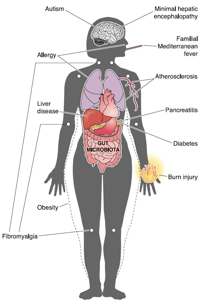 Figure 3. Microbiota-related diseases outside the GI-tract.