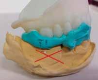 Scanning Preparation SCANNING THE BITE Complete Arch Bite Scan Position and Try-in Scanning The mandibular scan should be perpendicular to the
