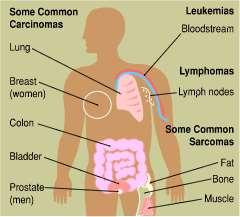 Different Kinds of Cancer Cancer can originate almost anywhere in the body. Carcinomas, the most common types of cancer, arise from the cells that cover external and internal body surfaces.