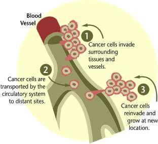 Invasion and Metastasis Cancers are capable of spreading through the body by two mechanisms: invasion and metastasis.