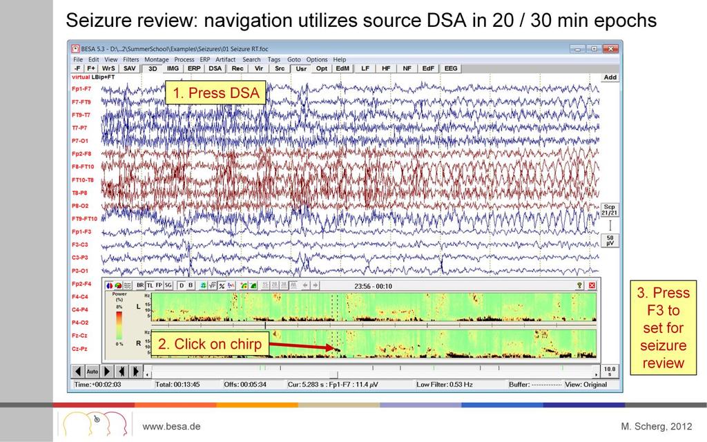 DSA (digital spectral arrays) can be used to identify periodic discharges with changing frequency that typically occur at seizure onset.