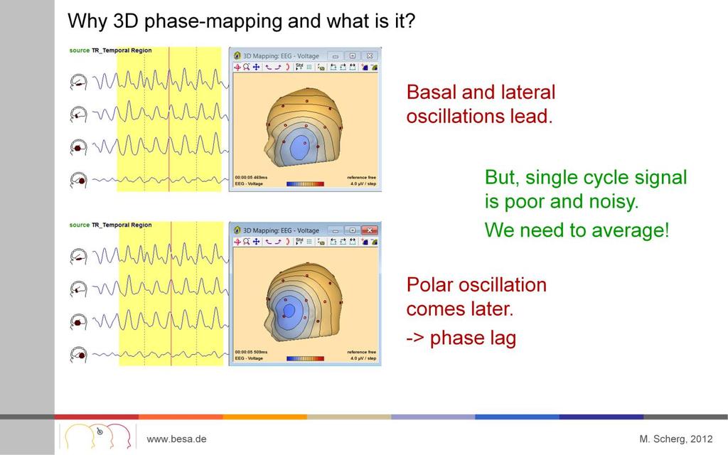 If we try to map voltage at seizure onset to localize, we will mostly fail since the signal is not clear.
