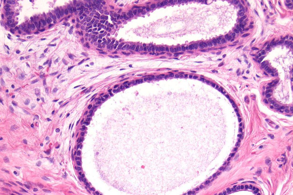 Microcysts Single layer
