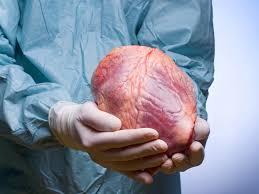 Slutin fr Liver Transplant, early clinical phase ITT* - Drug administratin t islated