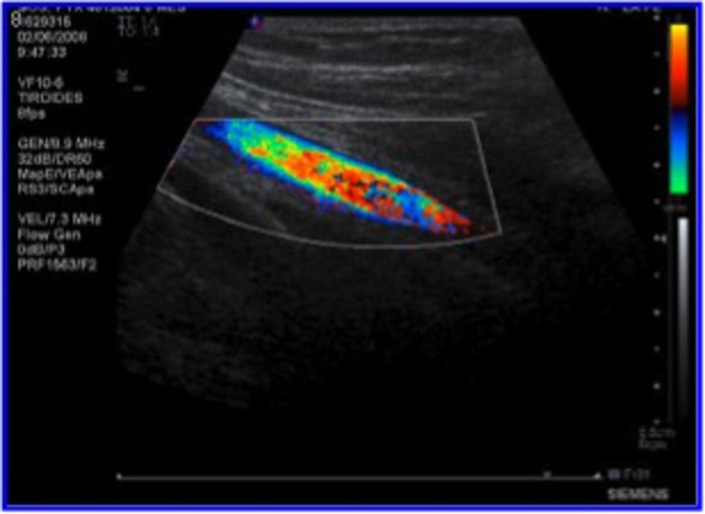 Fig. 23: Color-Doppler control of patients