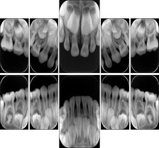 ID Name DENTAL IMAGE LAYOUT P003A standard pedodontic layout A 00 PA PEDO 02 STD 03 PEDO 04 12 STD 13 PEDO 14 P003A: 00 55, 54