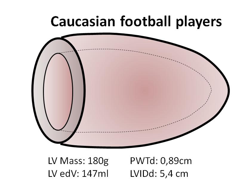 0.94 ± 0.12cm LV diameter: 5.2 ± 0.5cm RWT: 0.37 ± 0.