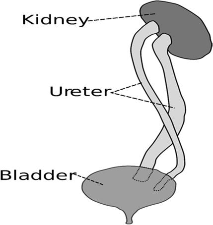 Chapter 14 Diseases of the Genitourinary System (N00-N99) Kidney Disease Neurogenic Bladder/ Obstructive Uropathy 143 Kidney Disease Chronic Kidney Disease is classified according to severity: N18.