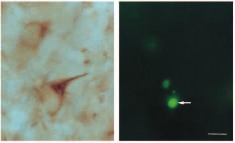 Changes in dependence on Trk signalling 3259 A B Fig. 4. Matching bright-field (A) and fluorescence (B) photomicrographs of a section through the trigeminal ganglion of an E12 trkb / embryo.