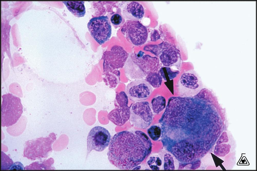 nucleus. Here, azurophilic granules form. Later stages may have a patchy eosinophilic cytoplasm. This stage marks the end of DNA duplication.