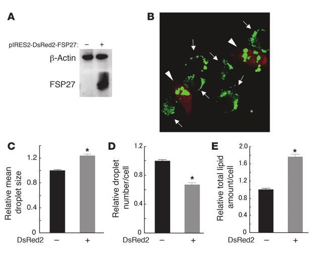 Figure 7 Formation of large lipid droplets induced by forced expression of FSP27 in COS cells.