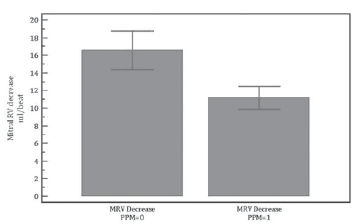Mitral RV decrease (ml/beat) N=419 EOAi 0.85 cm²/m²: 40.