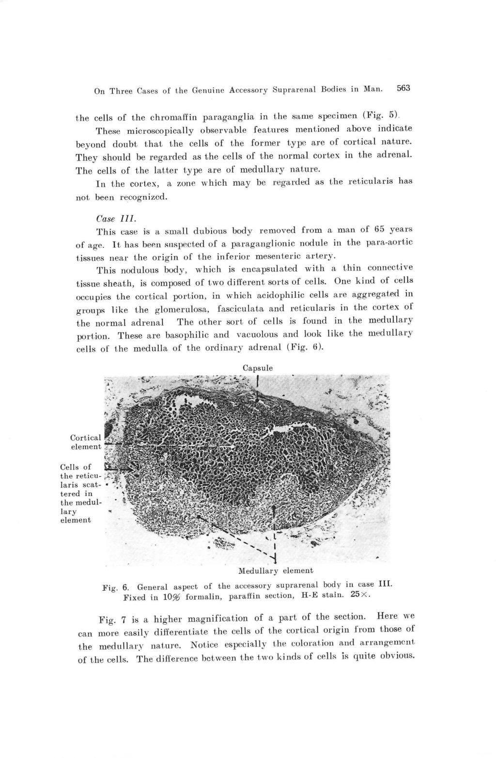 On Three Cases of the Genuine Accessory Suprarenal Bodies in Man. 563 the cells of the chromaffin paraganglia in the same specimen (Fig. 5).