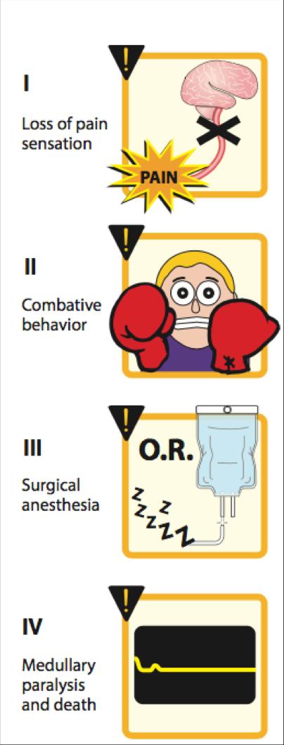 Depth of Anesthesia (GUEDEL S Signs) 15 Inhalation anesthetics Inhaled gases are used primarily for maintenance of anesthesia.