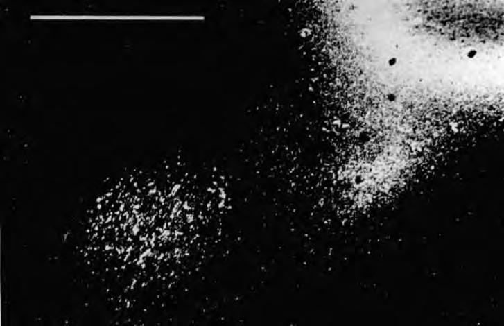 490 L.A. KRUBITZER ET AL. Fig. 13. A darkfield photomicrograph of a portion of a WGA-HRP injection in SII and resulting transported tracer in VS.