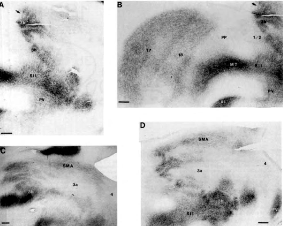 SOMATOSENSORY CORTEX 477 Fig. 3. Lightfield photomicrographs of the myeloarchitecture of somatosensory and surrounding cortex.