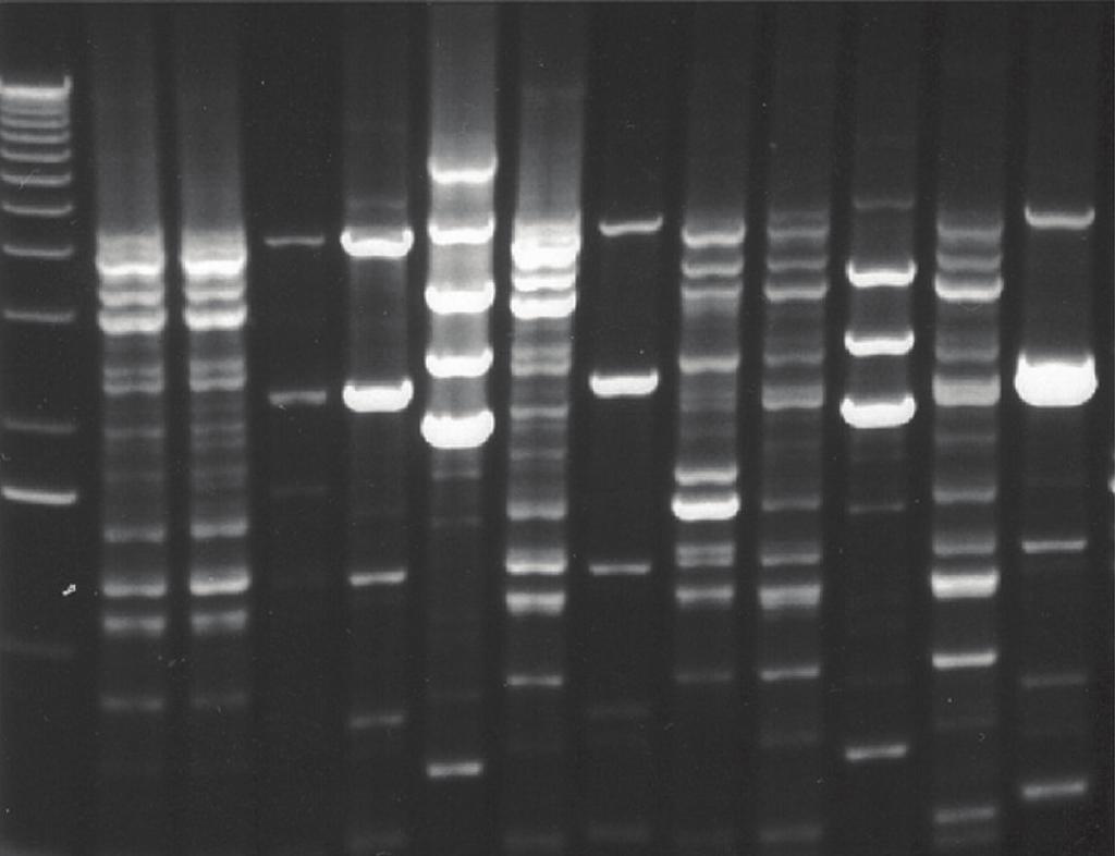 6 Infectious Diseases in Obstetrics and Gynecology 5090 4072 3054 2036 1636 MW C C J J G C J C G C J Figure 3: Representative rep-pcr DNA fingerprints from vaginal lactobacillus isolates.