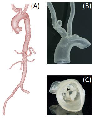 II. MATERIALS AND METHOD The bench-top model is a transparent, flexible model of the aorta, from the aortic valve to the common iliac artery, and includes the main side branches (Figure 1).