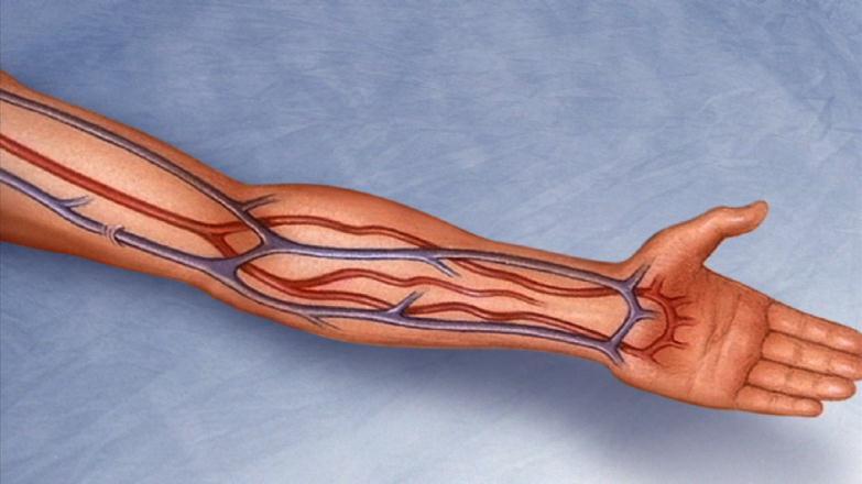 Arm Anatomy: Preferred Sites/Veins