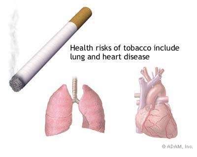 No smoking! Some diseases are difficult to categorize because they can harm the lungs in a number of ways.